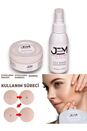Jem Kozmetik Bitkisel Renewal Cream Wart Set