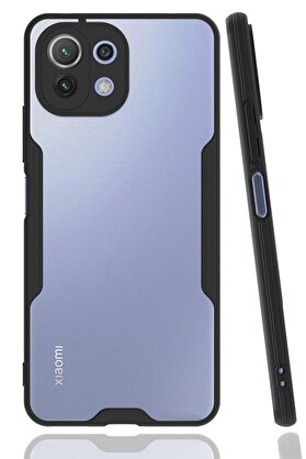 CepteToptan Xiaomi Mİ 11 Lite Kılıf Platin Silikon - Siyah - DROPX1781-1601