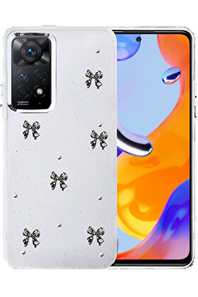 Buti̇k Xi̇aomi̇ Redmi̇ Note 11 Pro Fi̇yonk Desenli̇ Kapak - Desen 10-(5796)