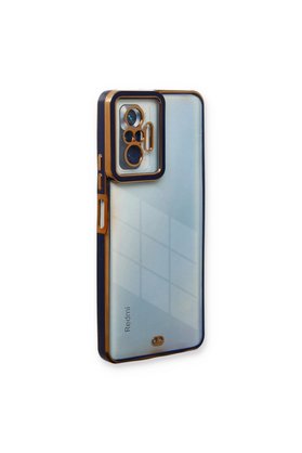 Evimdeyokyok Xiaomi Redmi Note 10 Pro Kılıf Liva Lens Silikon - Mavi