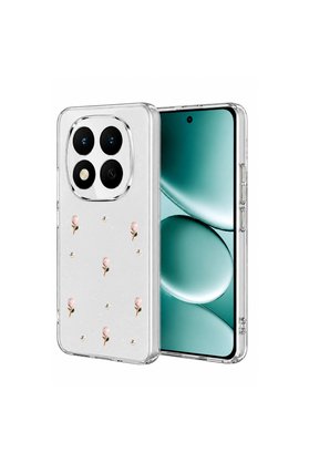 Evimdeyokyok Xiaomi Redmi Note 15 Pro 5G Fiyonk Desenli Kapak - Desen 6