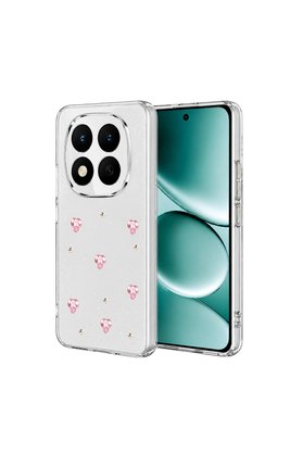Evimdeyokyok Xiaomi Redmi Note 15 Pro Plus 5G Fiyonk Desenli Kapak - Desen 3