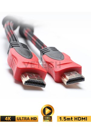Vetech HDMI Kablo 1.5 Metre Örgü Sargılı Dayanıklı Full HD Televizyon / Monitör / TV Hdmi Kablosu