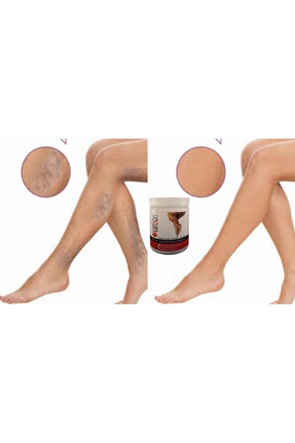 Vari̇son Va.ri̇s Selü.li̇t Bacak Bakım Kremi̇ 200 Ml X 2Adet
