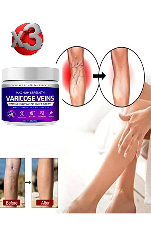 Adoi̇l Maxi̇mum Strength Vari̇cose Vei̇ns Bakım Kremi̇ 100 Ml X 3 Adet