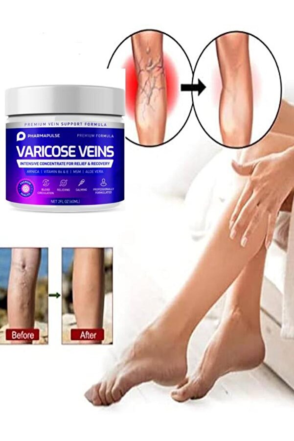 Adoi̇l Maxi̇mum Strength Vari̇cose Vei̇n Var.i̇s Bacak Bakım Masaj Kremi̇ 100 Ml 2 Adet