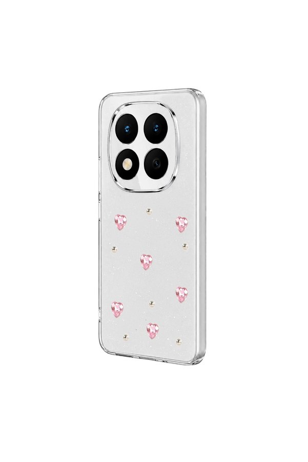 Evimdeyokyok Xiaomi Redmi Note 15 Pro 4G Fiyonk Desenli Kapak - Desen 3