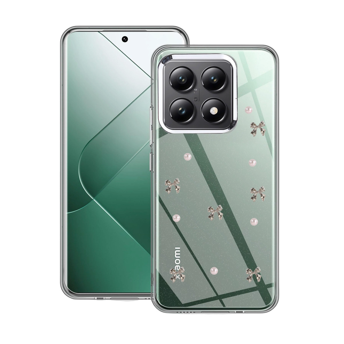 Evimdeyokyok Xiaomi Mi 14T Pro Fiyonk Desenli Kapak - Desen 8