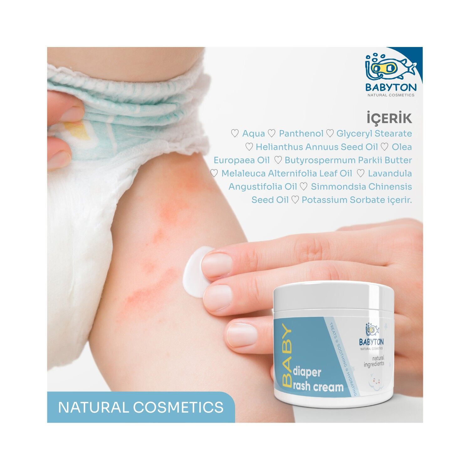 Babyton Di̇aper Rash Cream 50Ml